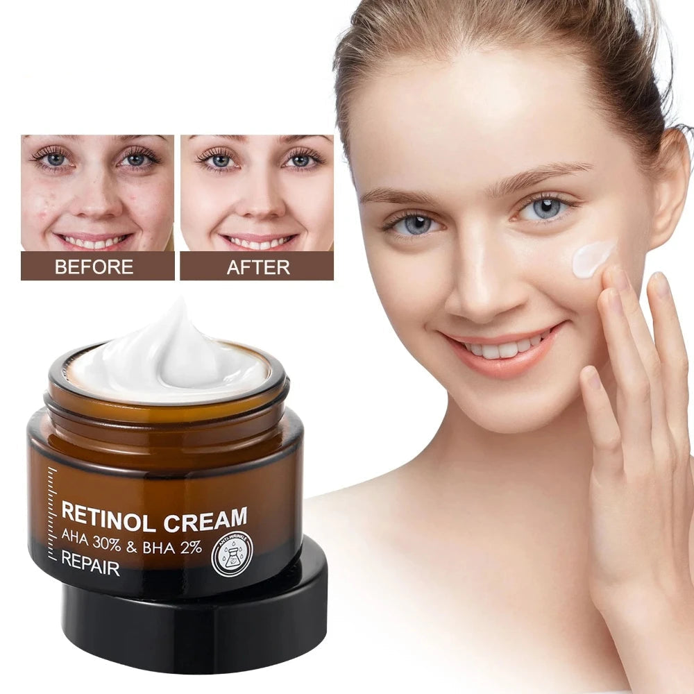 Retinol Anti-Wrinkle Moisturizer