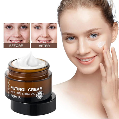 Retinol Anti-Wrinkle Moisturizer